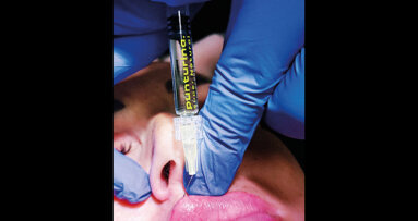 Un accesso semplificato alla medicina  estetica per gli odontoiatri: la formazione integrata di F.Aesthetic patrocinata SIMEO