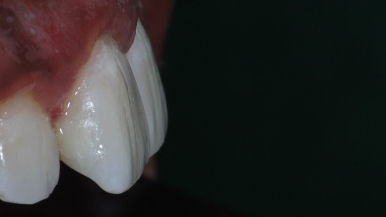 Fig 20: Textures achieved