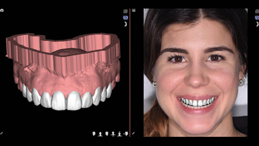 Fig. 8_Mockup motivazionale.