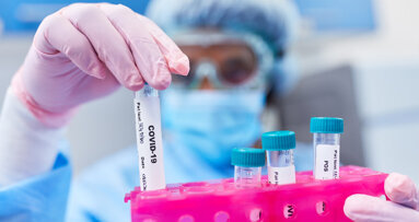 Saliva testing for SARS-CoV-2 takes off