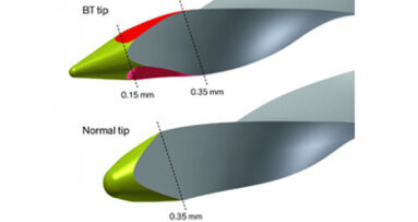 Instrumentación radicular biológica y conservadora