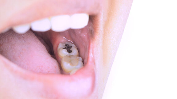 Beyond the clinic: FDI congress sessions place oral health in a wider policy context