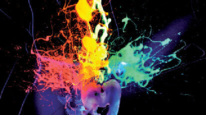 Kompobond: Vývoj nového dentálního výplňového materiálu – část I.