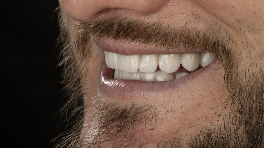 Figg. 10-12 - Fotografie finali.