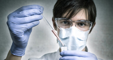 Forscher entdecken ungewöhnlichen Parodontitis-Hemmer