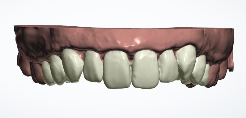 Fig. 13a: Current position
