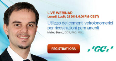 Utilizzo dei cementi vetroionomerici rivestiti per ricostruzioni dentarie permanenti
