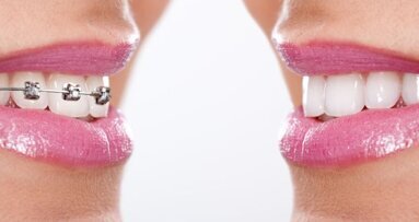 Tuchtcollege geeft tandarts-orthodontist tik op vingers