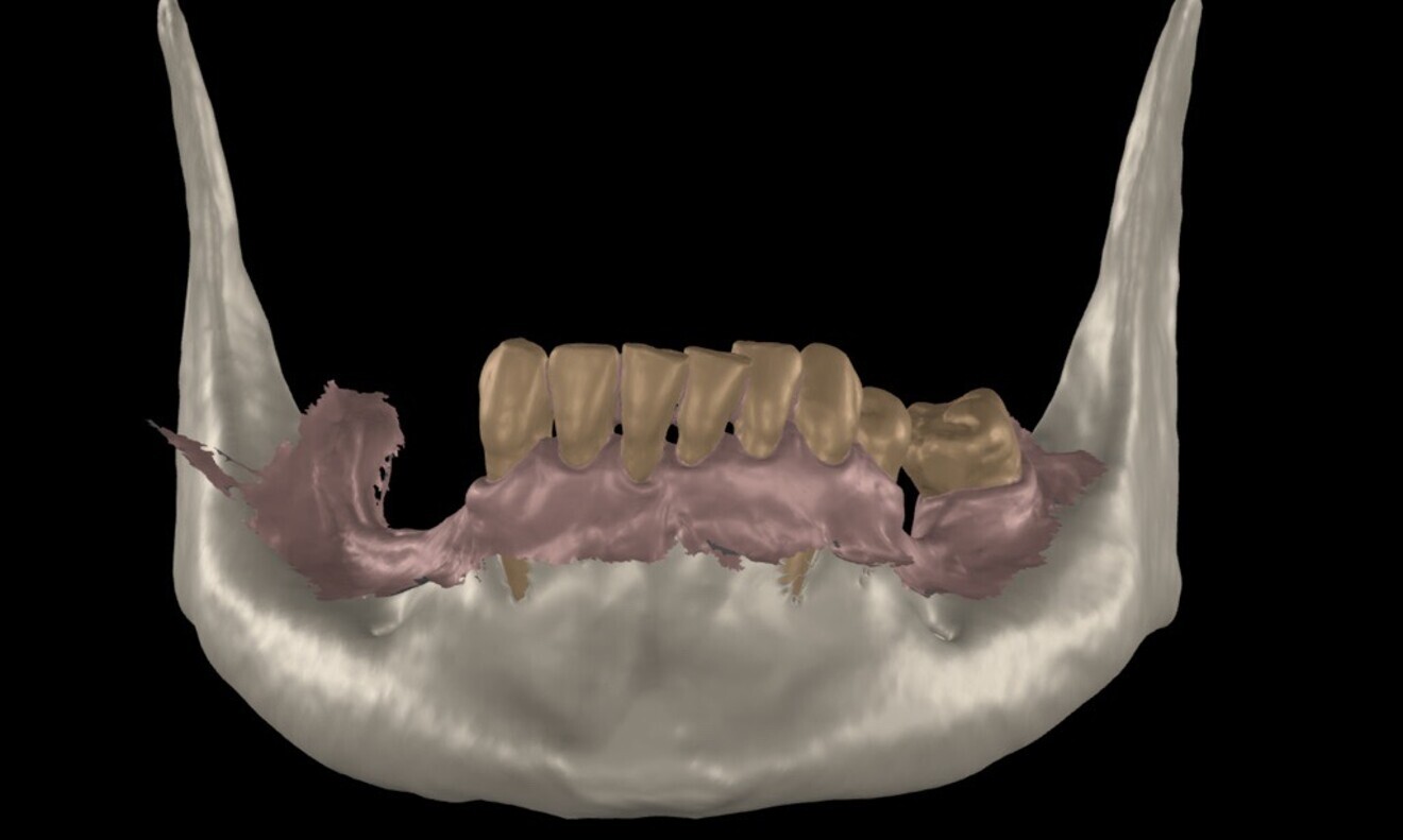 Fig. 9