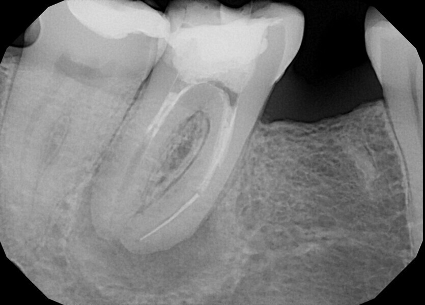 Fig. 9.