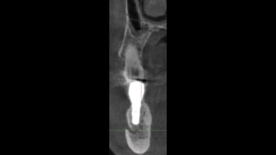 Fig. 18
