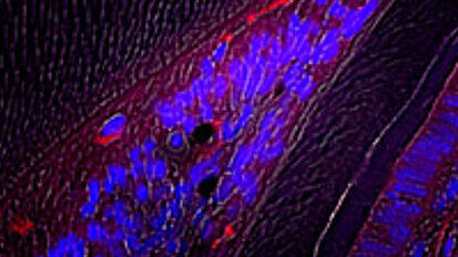Blood vessel cells aid tissue repair in teeth