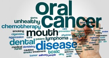 Oral Cancer Day: la prevenzione è sulla bocca di tutti