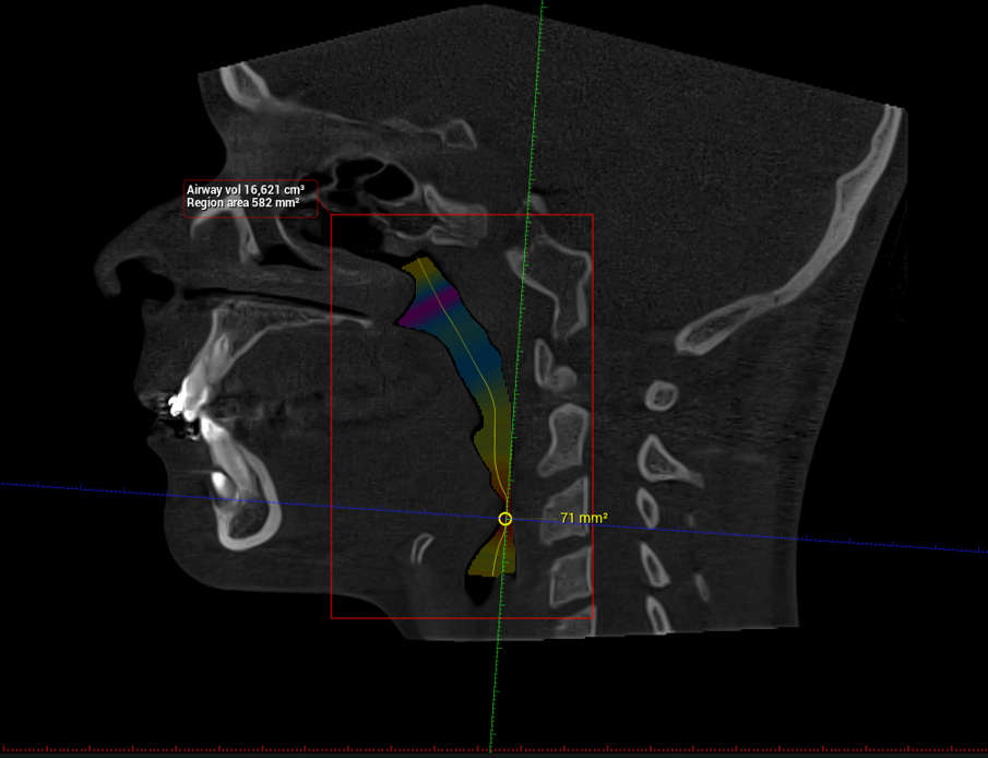Fig. 5
