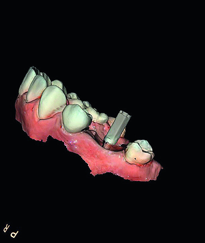 Fig. 11b