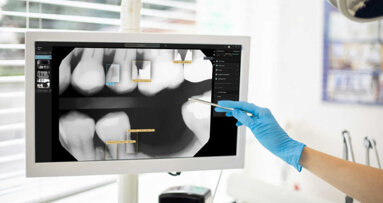 Segunda Opinião, por favor: ferramenta de radiologia assistida por IA aprovada na Oceaniaia