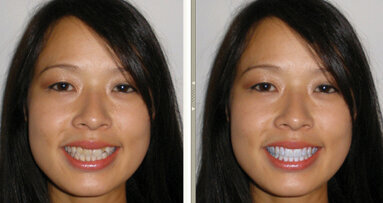Automate increasing your cosmetic revenue