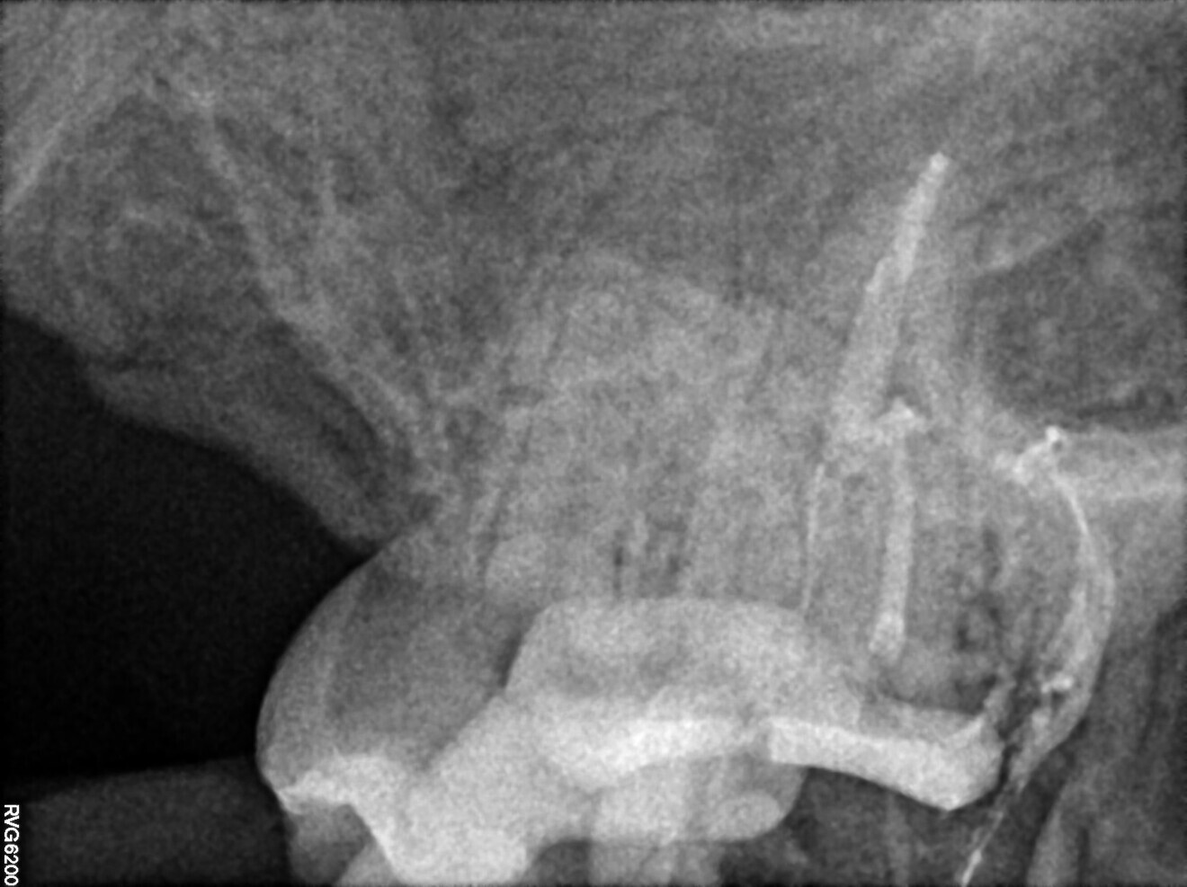 Fig. 12
