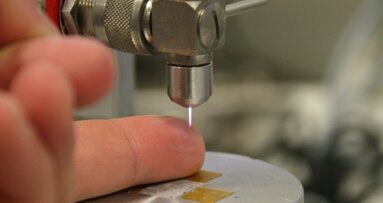 Plasmajettechnologie in der Zahnheilkunde