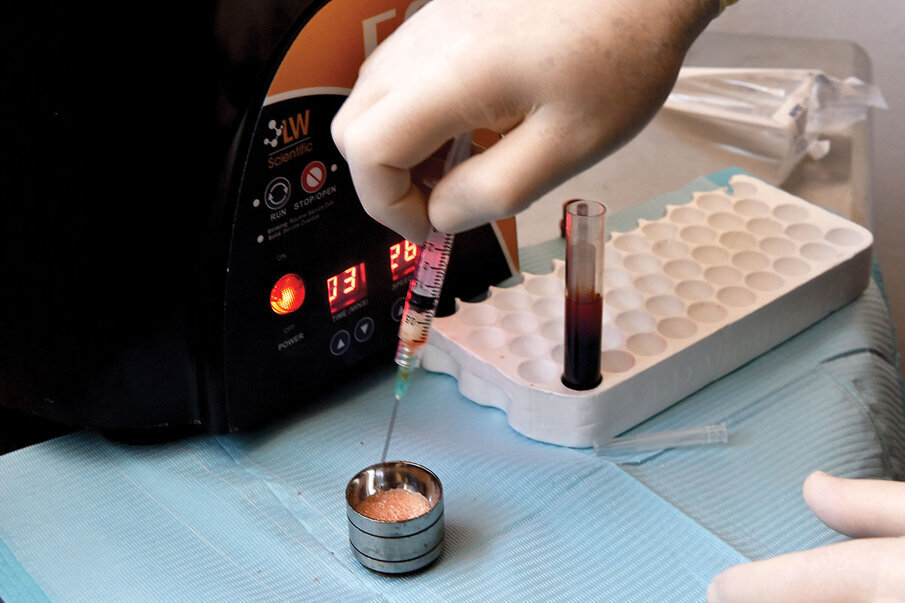 Fig. 13: The plasma is placed into the sterile dish containing the allograft particles.