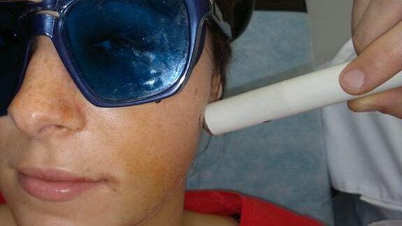 Zastosowanie niskoenergetycznego promieniowania laserowego w terapii bólu pozabiegowego