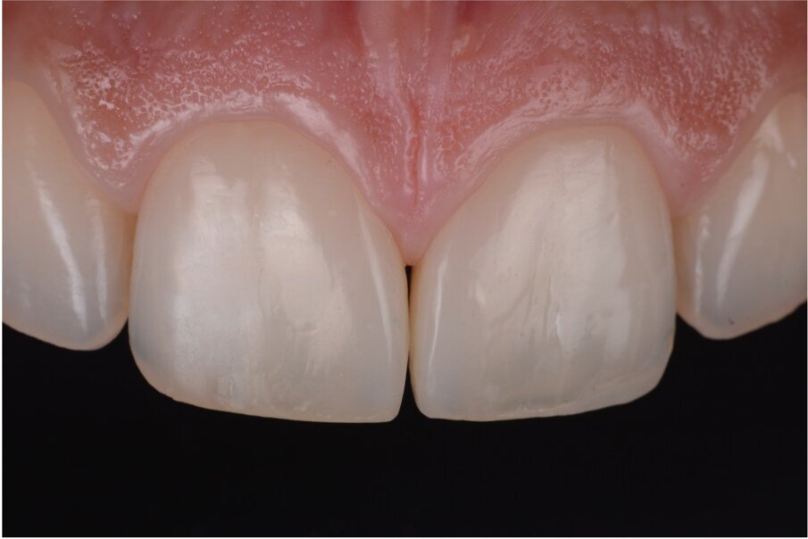 Case 3, Fig. 3.