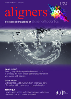 aligners international No. 1, 2024