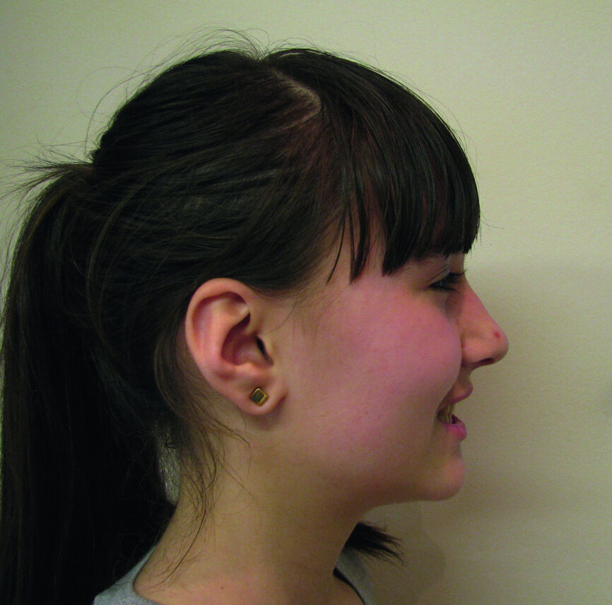 Fig. 9