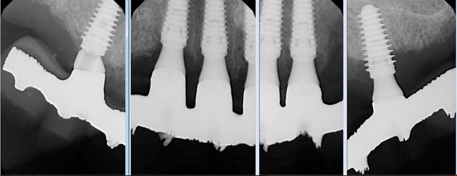 Fig. 10