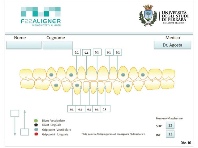 F22 Aligners