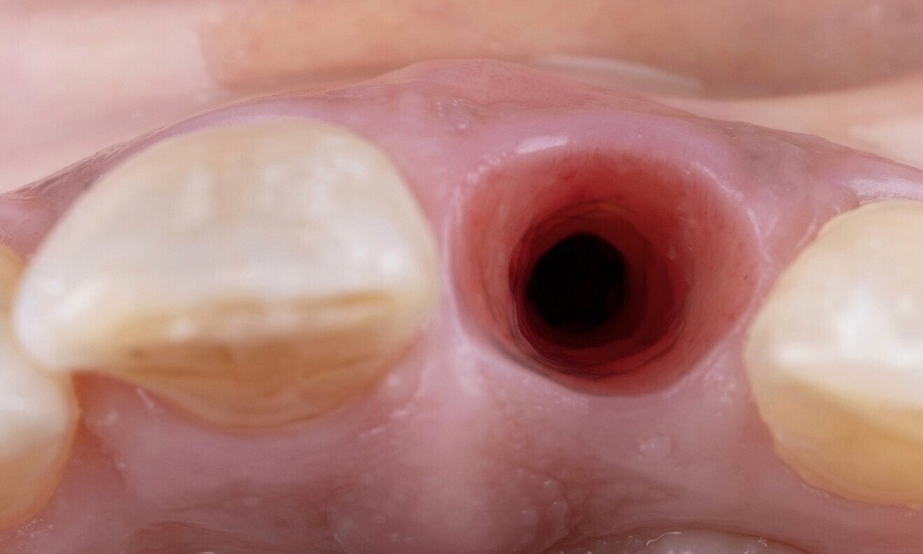 Fig. 10