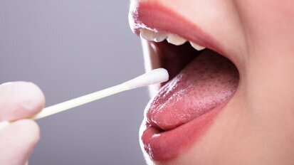 Une étude suggère que les tests de salive pourraient révolutionner le suivi de la parodontite
