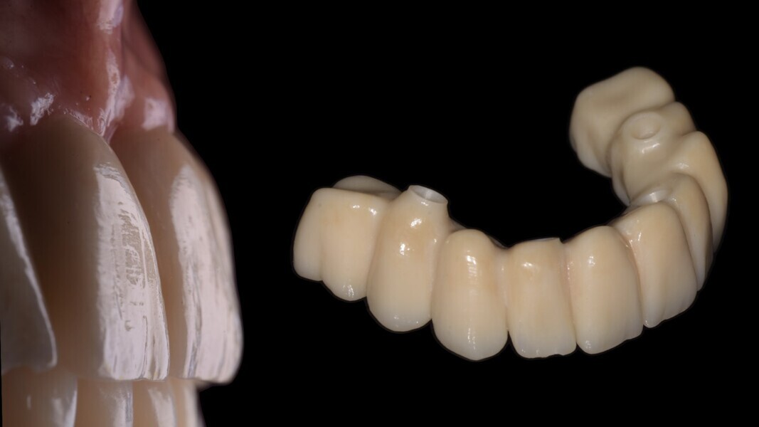 Fig. 16.