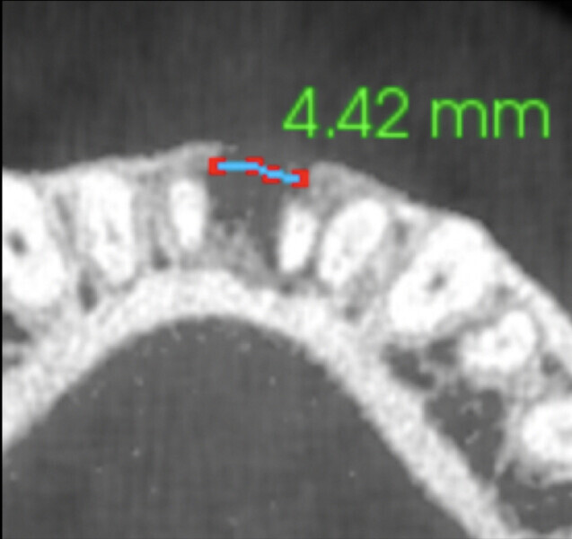 Fig. 5b: ...and at the nine-month follow-up.
