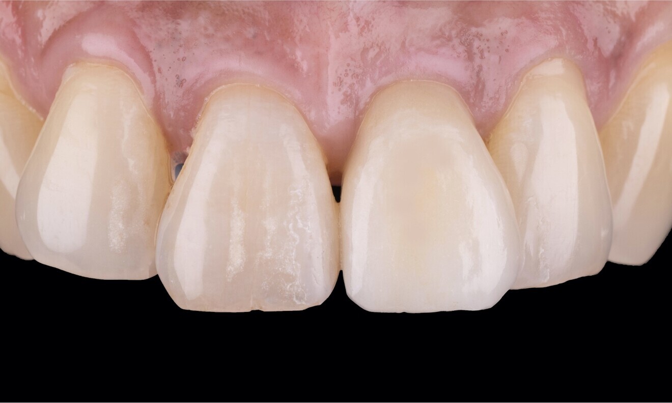 Fig. 15