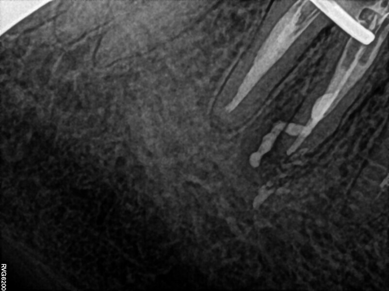 Fig. 36.