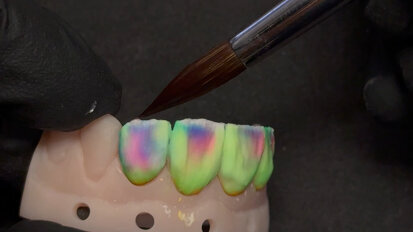 Kuraray Noritake – CERABIEN MiLai – Micro-layering of KATANA Zirconia veneers – Lusters