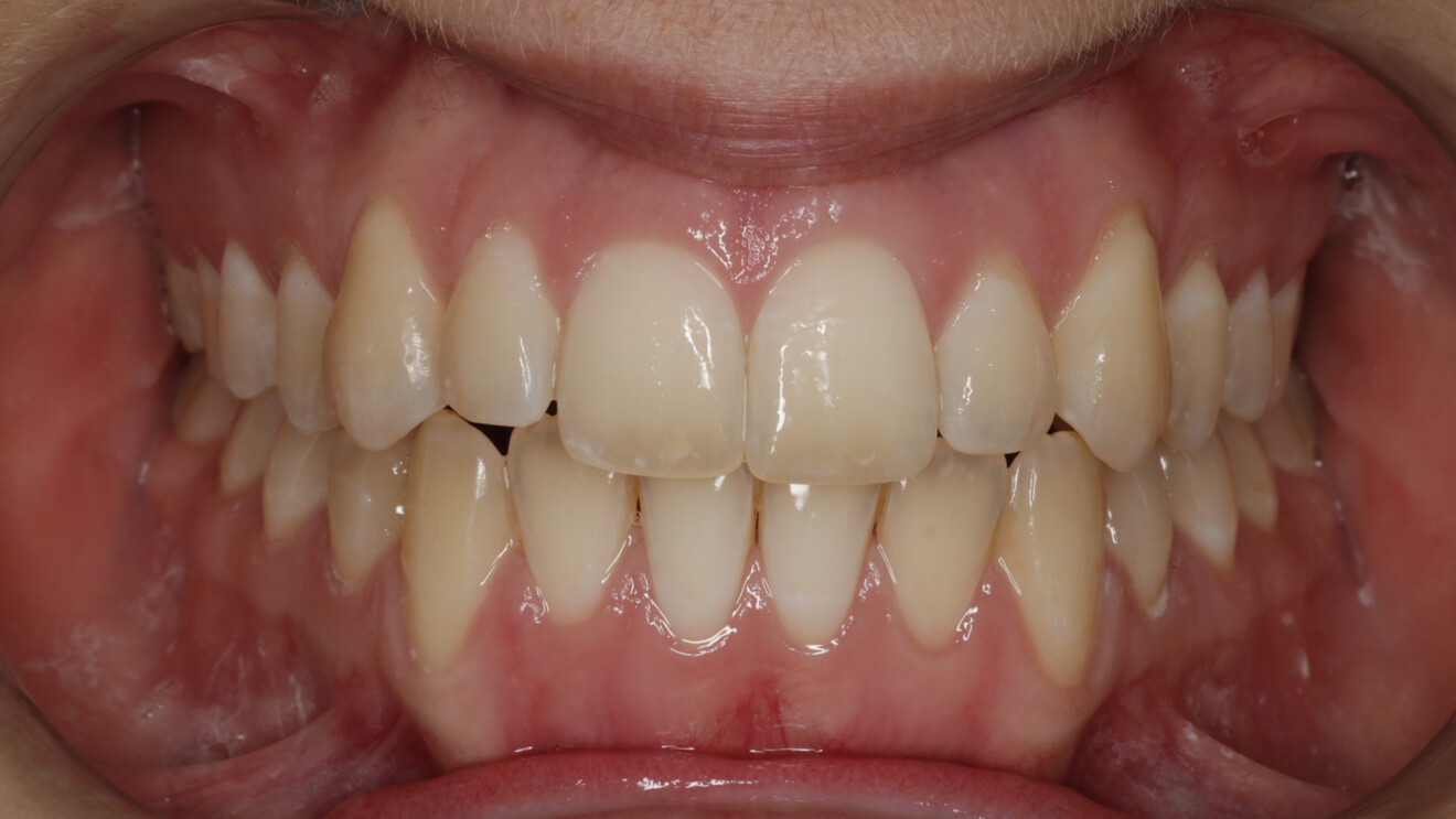 Fig. 6d