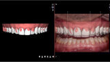 Fig. 11. Planificación del Diseño Digital de Sonrisa.