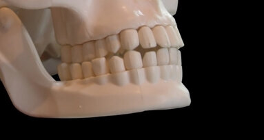 Stronger bone for oral surgery created by introducing microcracks