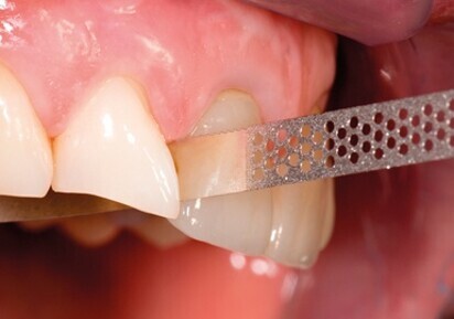 Strisce perforate diamantate