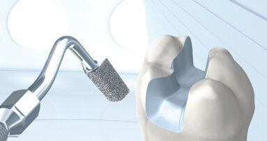 All-ceramic restorations: Webinar addresses key issues