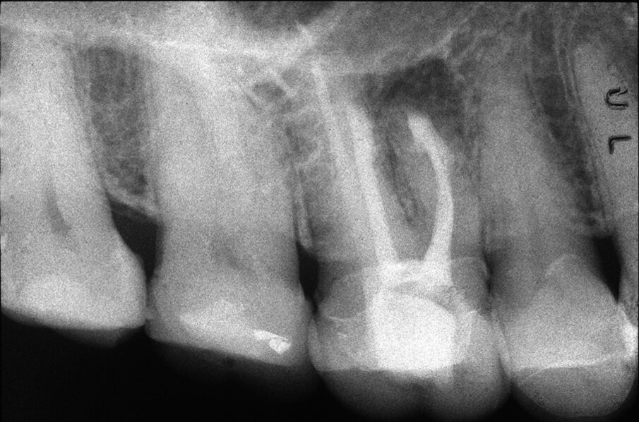 Fig. 1d