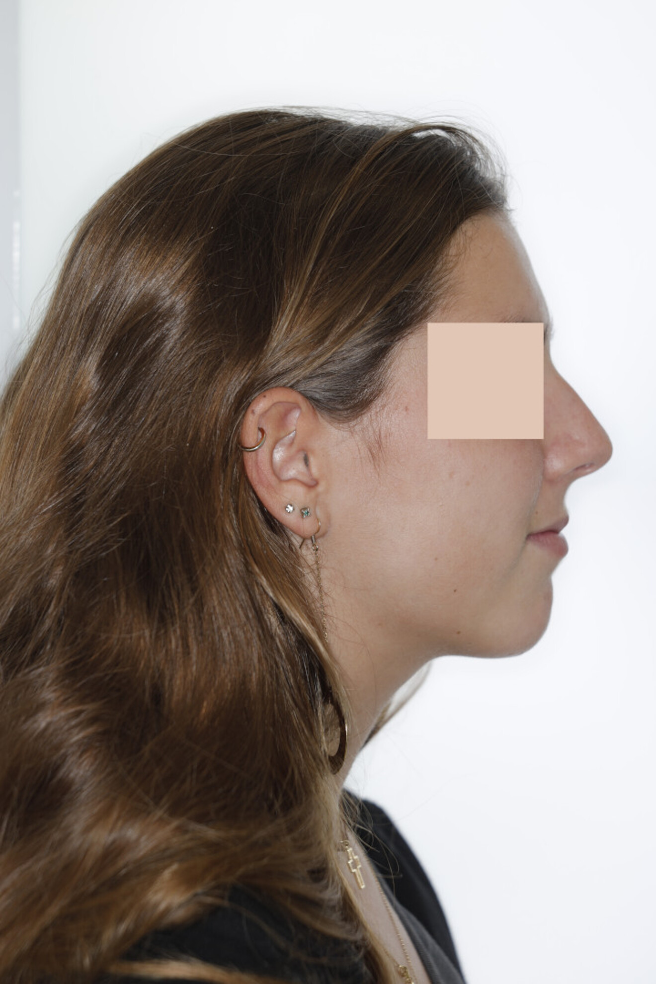 Fig. 1b