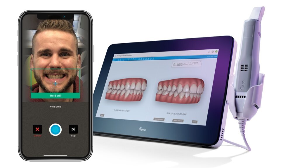 Align Technology lanceert Invisalign Smile Architect op online event op 22 februari