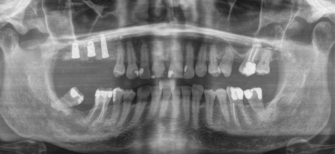 Fig. 33