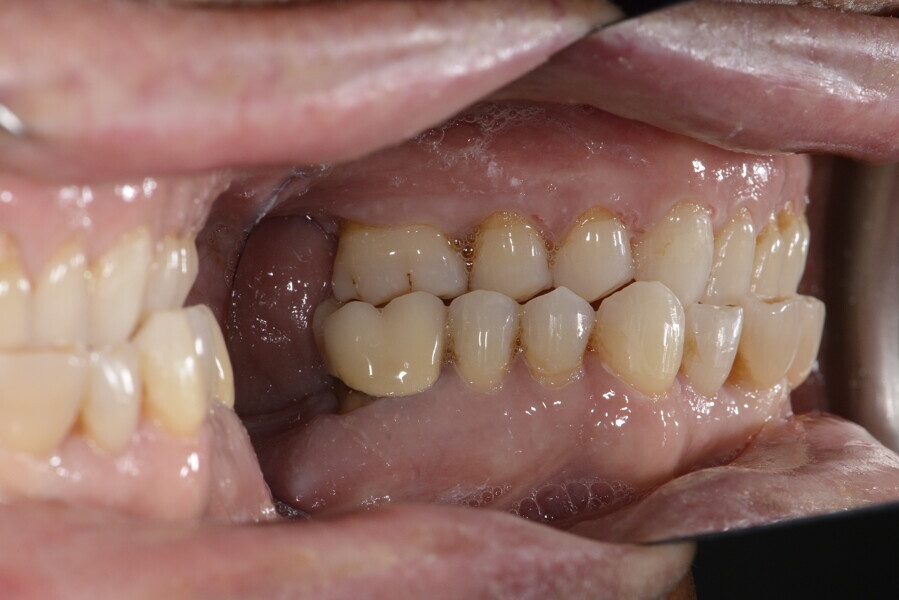 Fig. 19b
