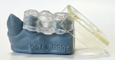 Researchers develop novel approach to dental restoration using 3D printing