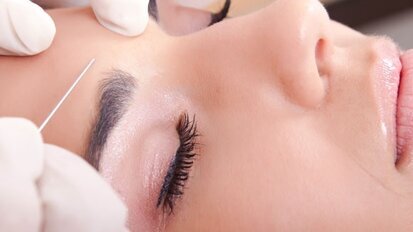 Botox gegen Heuschnupfen?