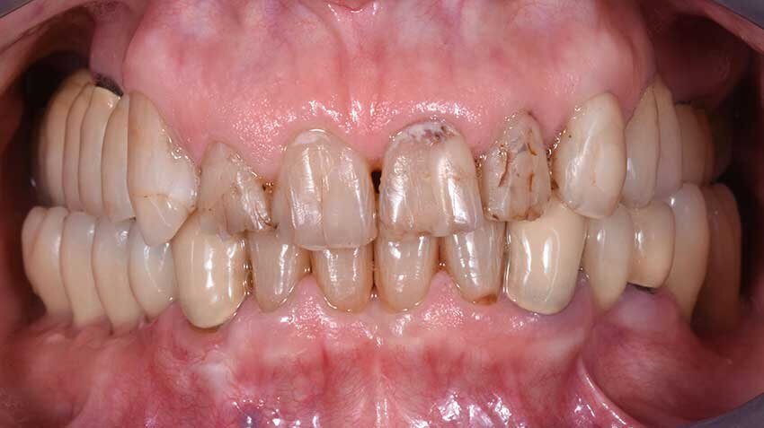 Fig. 16 - Follow up a 12 mesi.